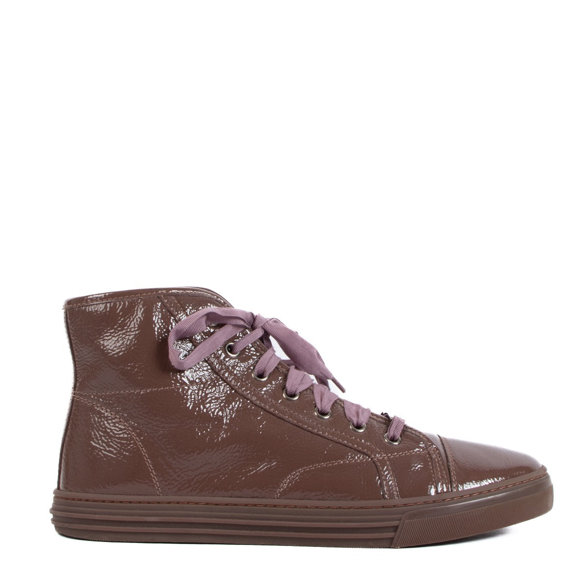 Gucci Rose Patent Leather High Top Sneakers